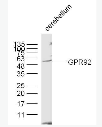 Anti-GPR92 antibody-G蛋白偶联受体GPR92蛋白抗体,GPR92