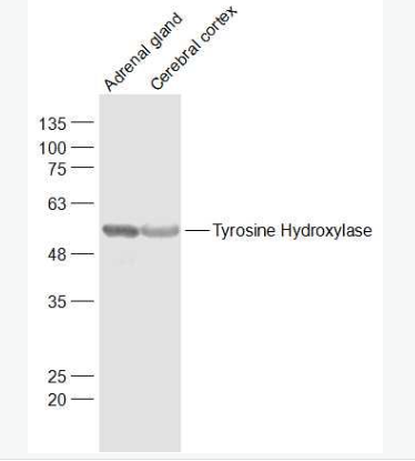 Anti-Tyrosine Hydroxylase  antibody,Tyrosine Hydroxylase