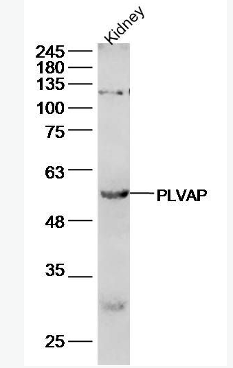 Anti-PLVAP  antibody-质膜囊泡相关蛋白抗体,PLVAP