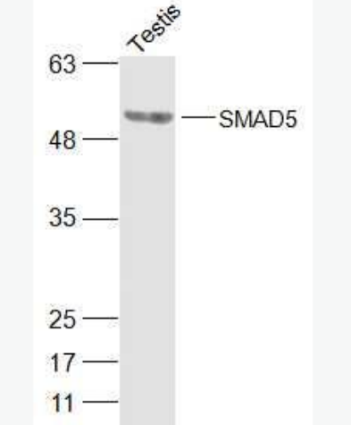 Anti-SMAD5 antibody-細(xì)胞信號轉(zhuǎn)導(dǎo)分子SMAD5抗體,SMAD5