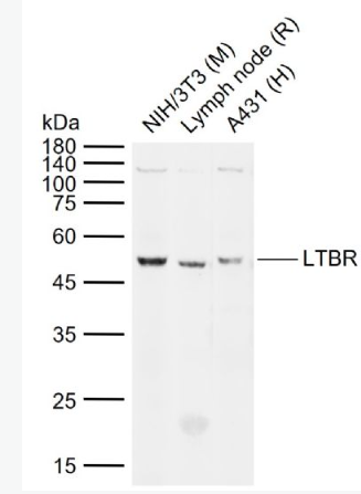 Anti-LTBR antibody-淋巴毒素-β受抗體,LTBR