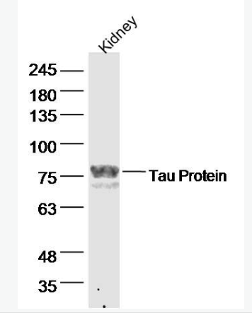 Anti-Tau antibody-微管相关蛋白抗体,Tau
