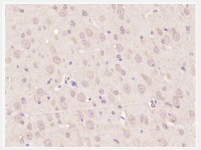 Anti-Nestin antibody-巢蛋白/神经上皮干细胞蛋白抗体,Nestin