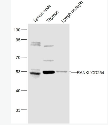 Anti-RANKL/CD254 antibody-骨保护蛋白配体/破骨细胞分化因子抗体,RANKL/CD254