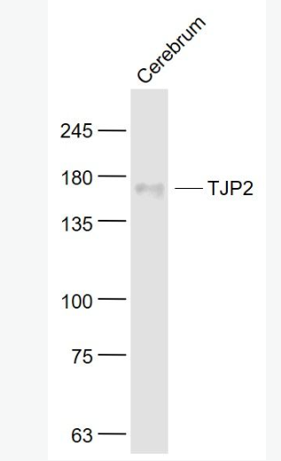 Anti-TJP2  antibody-紧密连接蛋白2抗体,TJP2