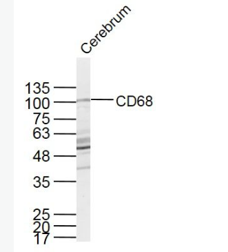 Anti-CD68 antibody-CD68抗体,CD68