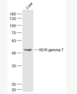 Anti-ROR gamma T antibody-C维甲酸相关孤儿受体γt抗体,ROR gamma T