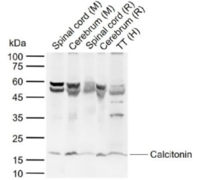 Anti-Calcitonin antibody-降钙素抗体,Calcitonin