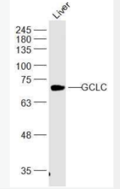 Anti-GCLC  antibody-γ谷氨酰半胱氨酸合成酶抗体,GCLC