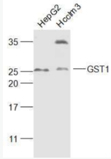 Anti-GST1 antibody-谷胱甘肽转移酶抗体,GST1