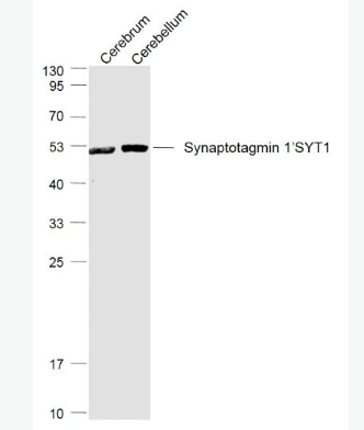 Anti-Synaptotagmin 1/SYT1 antibody-突触结合蛋白1抗体,Synaptotagmin 1/SYT1