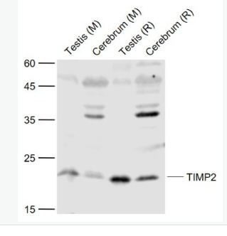 Anti-TIMP-2 antibody-金屬蛋白酶組織抑制因子-2抗體,TIMP-2