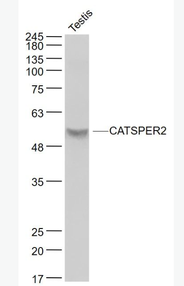 Anti-CATSPER2 antibody-阳离子通道精子相关蛋白2抗体,CATSPER2