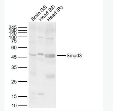 Anti-Smad3 antibody-细胞信号转导分子SMAD3抗体,Smad3