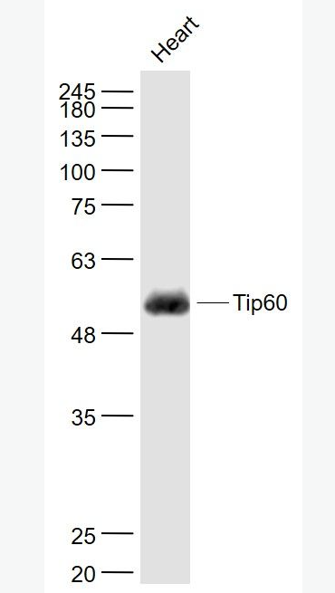 Anti-KAT5 / Tip60 antibody-TIP60抗体,KAT5 / Tip60