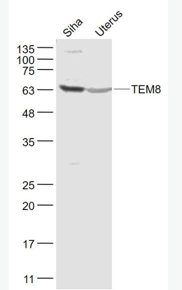Anti-TEM8  antibody-肿瘤血管内皮标志物8抗体,TEM8