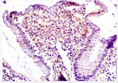 Anti-Lpin1 protein  antibody-Lpin1 抗体,Lpin1 protein