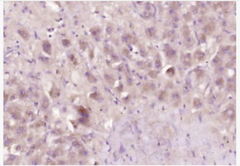 Anti-SERPINC1 antibody-抗凝血酶3抗体,SERPINC1