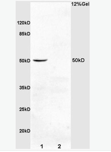 Anti-PDCD4  antibody-凋亡相关蛋白4抗体,PDCD4