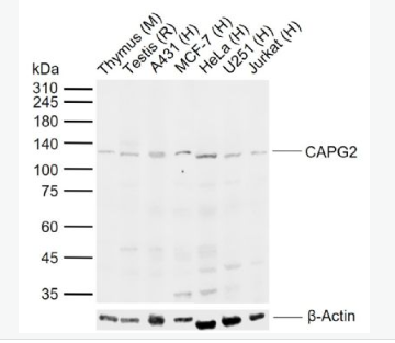 Anti-CAPG2 antibody-染色體相關(guān)蛋白2抗體,CAPG2