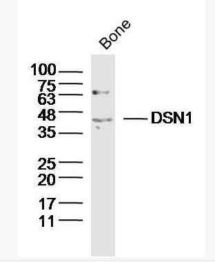 Anti-DSN1 antibody-着丝粒相关蛋白DSN1抗体,DSN1