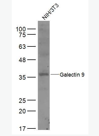 Anti-Galectin 9 antibody-半乳糖凝集素9抗体,Galectin 9