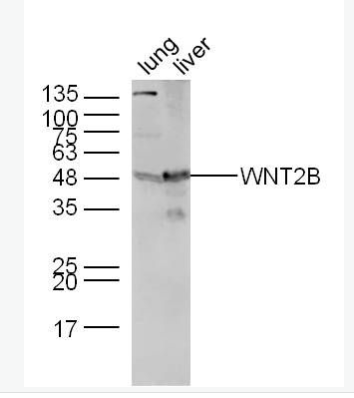 Anti-WNT2B antibody-信号通路Wnt2B抗体,WNT2B