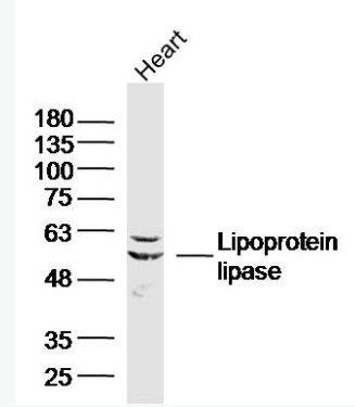 Anti-Lipoprotein lipase antibody-脂蛋白脂酶抗体,Lipoprotein lipase