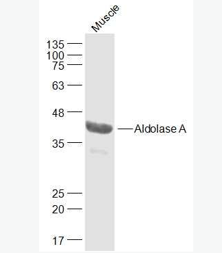 Anti-Aldolase A antibody-醛缩酶A抗体,Aldolase A