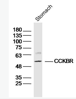 Anti-CCKBR antibody-促胃泌素受体抗体,CCKBR