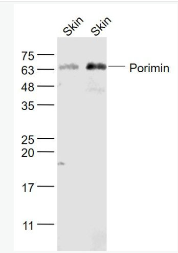 Anti-Porimin antibody-前细胞胀亡受体诱导膜损伤蛋白抗体,Porimin