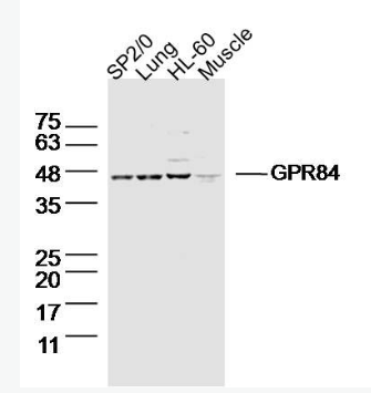 Anti-GPR84 antibody-G蛋白偶联受体84抗体,GPR84