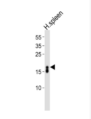 Anti-Ribonuclease 3/ECP antibody-嗜酸性粒細(xì)胞陽離子蛋白抗體,Ribonuclease 3/ECP