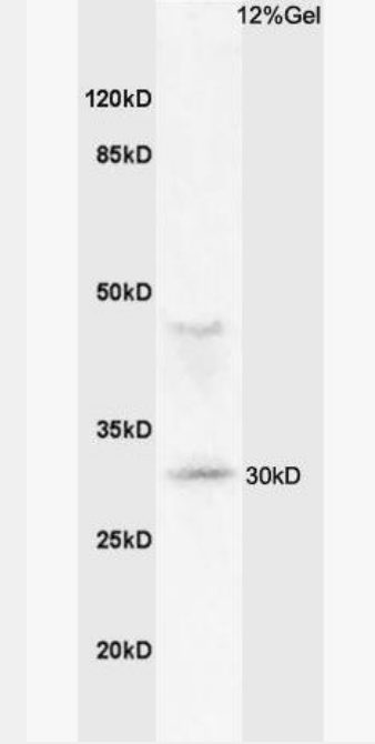 Anti-MHC Class II antibody-組織相容性復合體蛋白2（HLA-DMB）抗體,MHC Class II