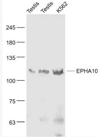 Anti-EPHA10 antibody-酪氨酸蛋白激酶受體A10抗體,EPHA10