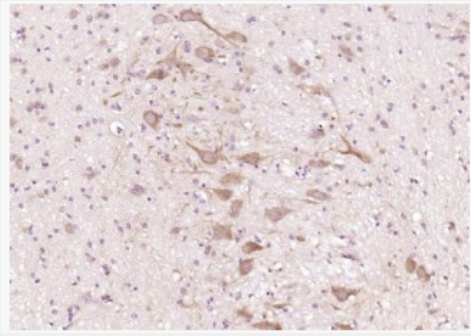 Anti-CTNND2/delta 2 Catenin antibody-δ-連環(huán)蛋白抗體,CTNND2/delta 2 Catenin