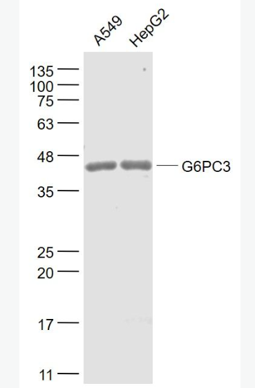 Anti-G6PC3 antibody-葡萄糖-6-磷酸酶3/G6Pase-β抗體,G6PC3