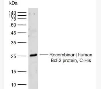 Anti-Bcl-2 alpha antibody-Bcl2 alpha蛋白抗体,Bcl-2 alpha