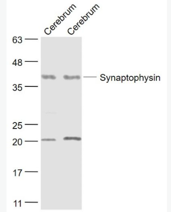 Anti-Synaptophysin antibody-突觸小泡蛋白P38抗體,Synaptophysin