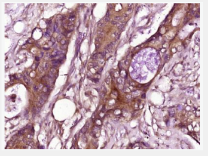 Anti-CCL26 antibody-趋化因子26/嗜酸粒细胞趋化蛋白3抗体,CCL26