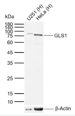 Anti-GLS1 antibody-谷氨酰胺酶1/Glutaminase抗体,GLS1