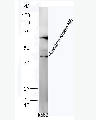Anti-Creatine Kinase MB antibody-肌酸激酶同工酶CKMB抗体,Creatine Kinase MB
