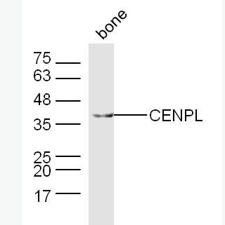 Anti-CENPL antibody-着丝粒蛋白L抗体,CENPL