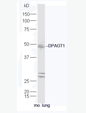 Anti-DPAGT1antibody-DPAGT1蛋白抗體,DPAGT1