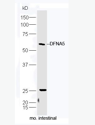 Anti-DFNA5 antibody-耳聋相关常染色体显性遗传5抗体,DFNA5