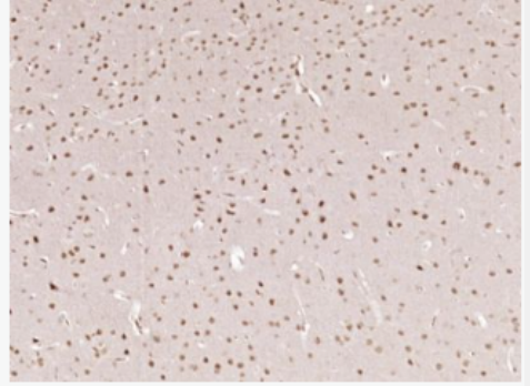 Anti-phospho-AMPK alpha 1 (Thr183) + AMPK alpha 2 (Thr172) antibody-磷酸化腺苷單磷酸活化蛋白激酶α1抗體,phospho-AMPK alpha 1 (Thr183) + AMPK alpha 2 (Thr172)