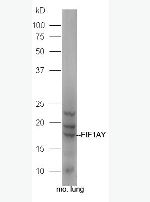 Anti-EIF1AY antibody-真核翻译起始因子1A抗体,EIF1AY