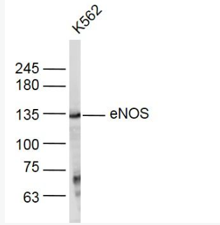 Anti-eNOS  antibody-一氧化氮合成酶-3（内皮型）抗体,eNOS