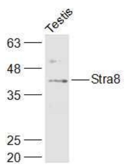 Anti-Stra8 antibody-视黄酸激活基因8抗体,Stra8