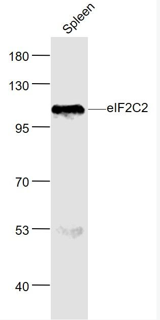 Anti-AGO2  antibody-真核翻译起始因子2C2抗体,AGO2